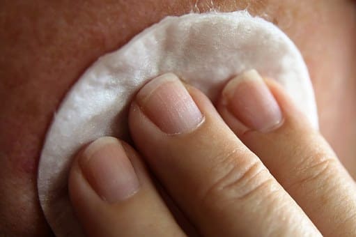 Acne - Inflamed Pimple Under Skin