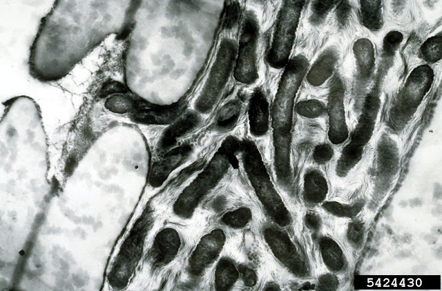 Foto de microscopio electrónico de Xylella fastidiosa