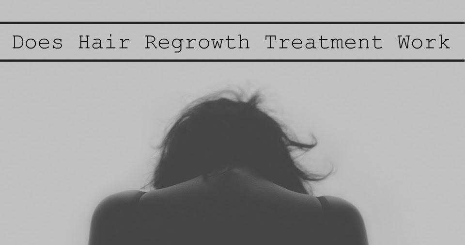 Does Hair Regrowth Treatment Work A Very Sweet Blog