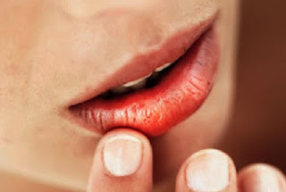 Khô miệng có gây hại gì không?