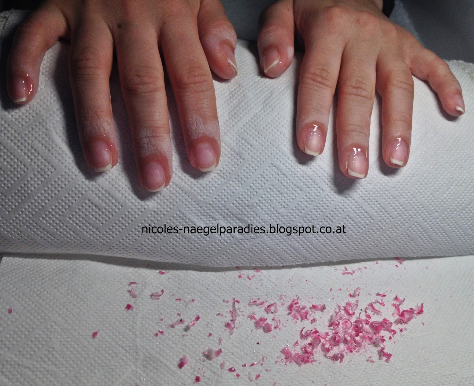 Shellac Entfernen Mit Spulmittel