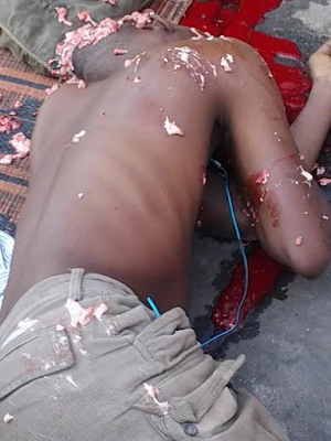 5 Graphic Photos: Fuel Truck crushes the head of a man sleeping under it