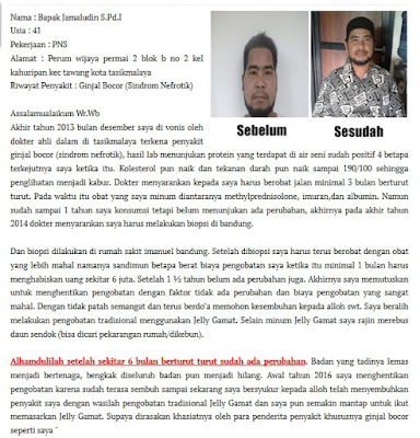 Cara Mengatasi Susah Buang Air Kecil (Anuria) Secara Alami Cara Mengatasi Susah Buang Air Kecil (Anuria) Secara Alami