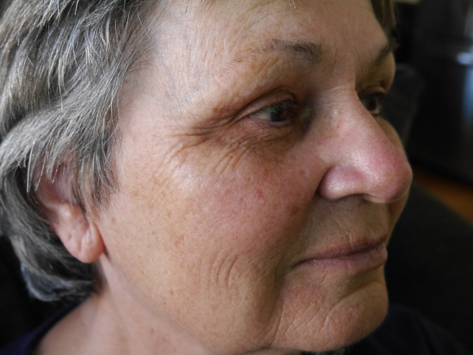 svájci anti aging fotóalbum összehasonlítás arc kezelés