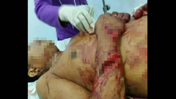 https://4.bp.blogspot.com/-z3cpoCWSSNA/WWIHmezjYQI/AAAAAAABTyM/-KtnYuTUgAk-UYak-qZjMeTEQUi26OGQgCLcBGAs/s1600/hermansyah%2Bdibacok%2Bpakar%2Bit%2Bitb.jpg