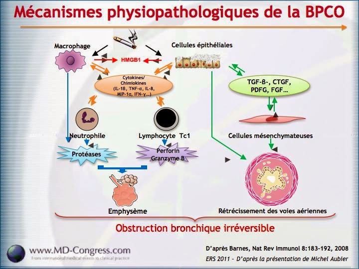 TherapeutiqueMed BPCO EXACERBATION