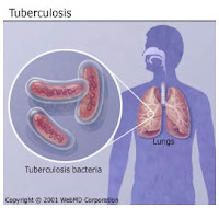 Tanaman Obat Tradisional Untuk Tbc
