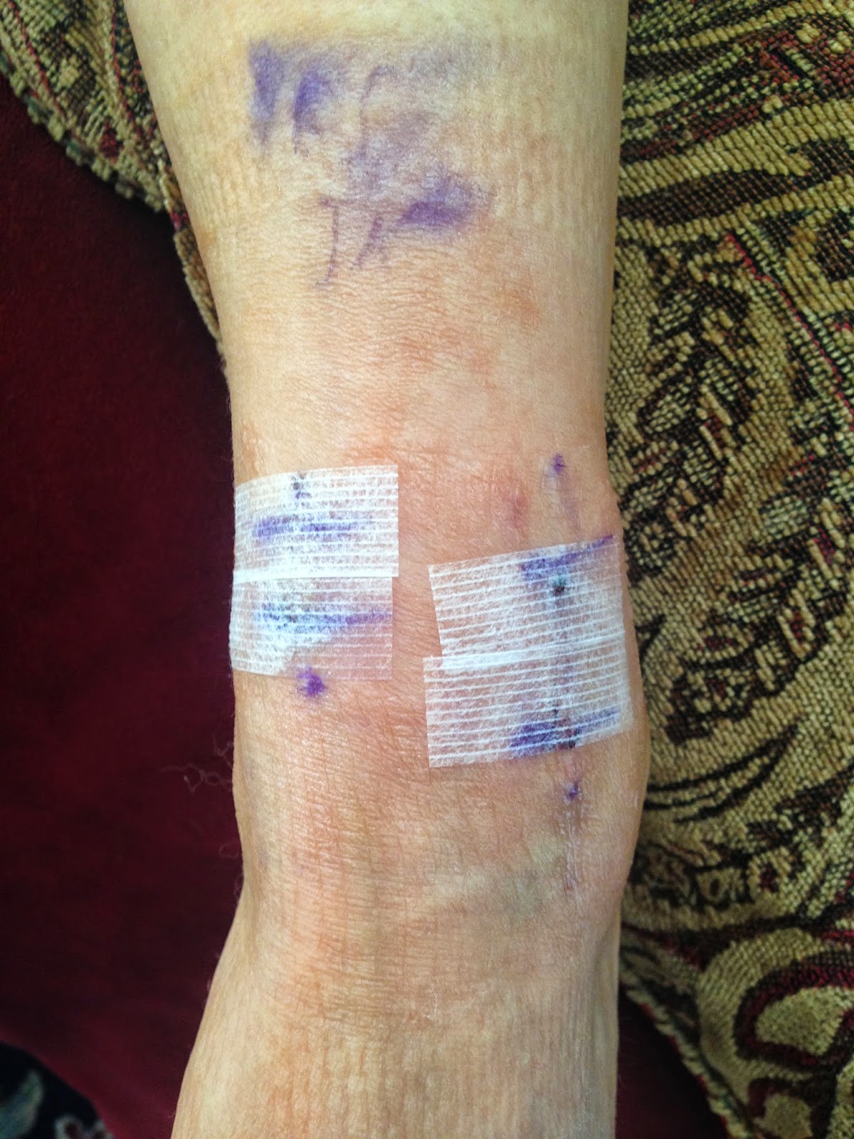 bartonella lyme foot ing she mean hates joy called having did much days three club which