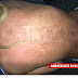ANASTASIA ASHLEY: DESNUDA Y ATACADA POR MOSQUITOS