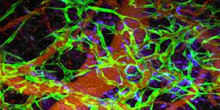 Reprogrammed cells generate blood vessels - Havard