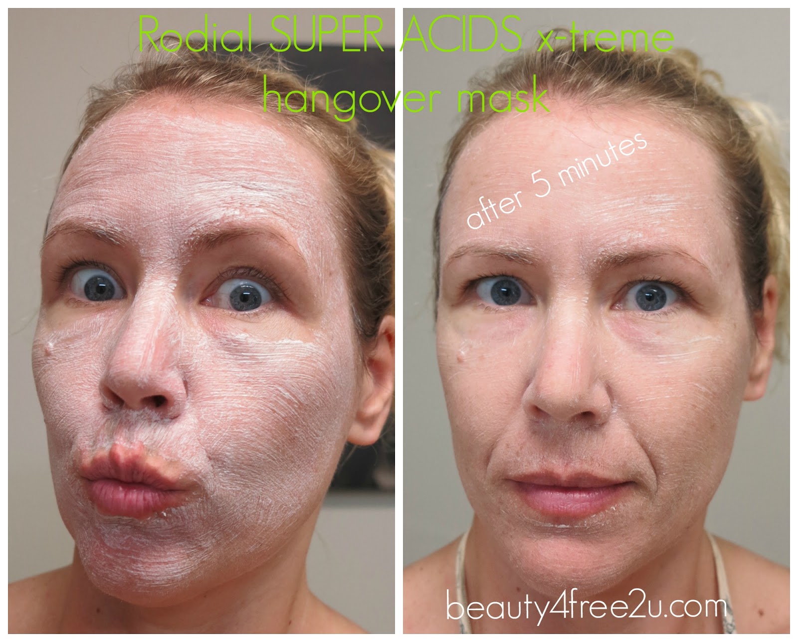 RODIAL BEE VENOM SKIN CARE REVIEW