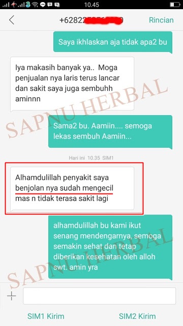 Testimoni Obat Penghilang Benjolan di Kemaluan Wanita Sebelah Kiri dan Kanan Tradisional QNC JELLY GAMAT Testimoni Obat Penghilang Benjolan di Kemaluan Wanita Sebelah Kiri dan Kanan Tradisional QNC JELLY GAMAT