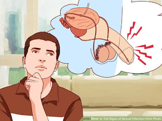 Obat Keluar Cairan Kental Dari Penis Obat Keluar Cairan Kental Dari Penis