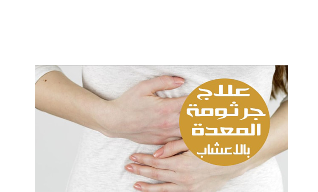 علاج جرثومة المعدة بالاعشاب مجرب علاج جرثومة المعدة بالاعشاب مجرب