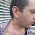 VEREADOR DANIEL LIMA PRTB É AGREDIDO NA CIDADE DE VIÇOSA DO CEARÁ.