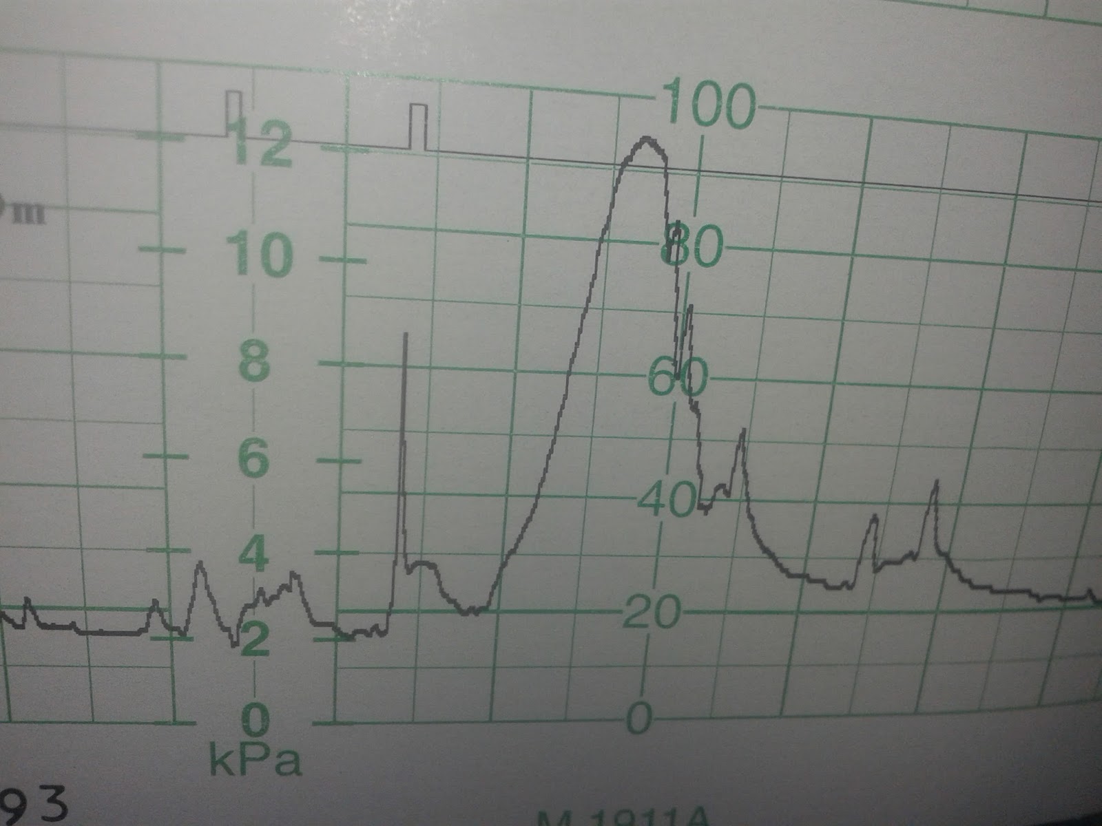 KTG nie ma co panikować