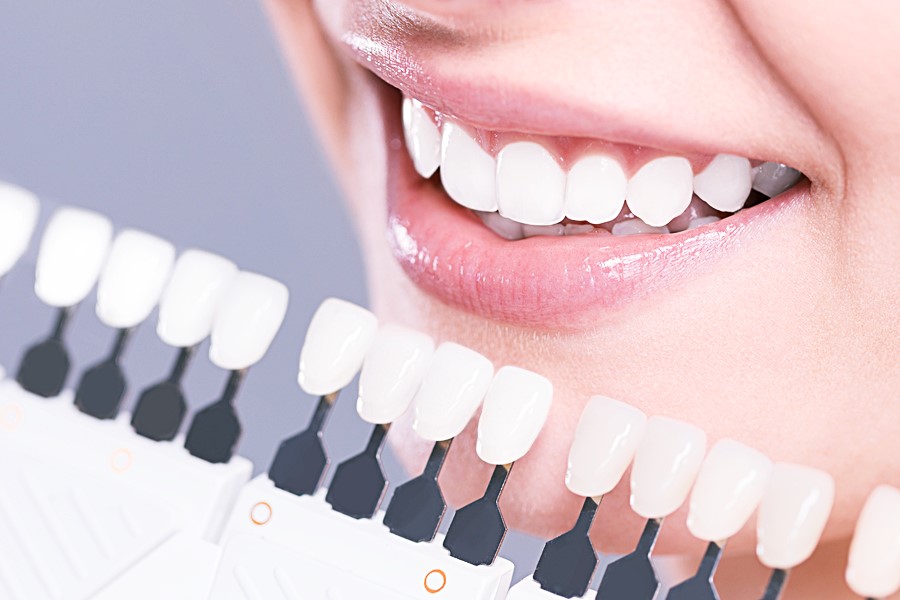 Mitos e Verdades: Clareamento Dental ðŸ˜¬