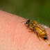 [Ελλάδα]Ήταν αλλεργική και την τσίμπησε μέλισσα…