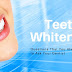 Frequently Asked Questions About Teeth Whitening