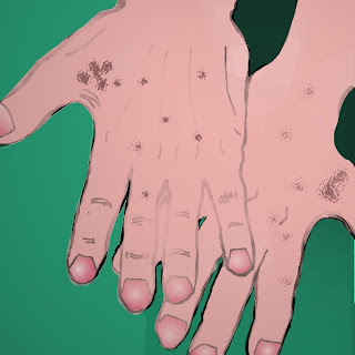Come liberarsi da pigmentazione su una faccia e su mani