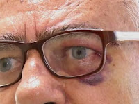 Médico foi agredido em postode saúde de Tibau do Sul (Foto: Reprodução/Inter TV Cabugi)