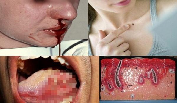 Hati-hati 15 Tanda Kanker ini Sering Diremehkan dan Diabaikan Wanita Hati-hati 15 Tanda Kanker ini Sering Diremehkan dan Diabaikan Wanita