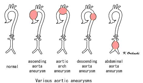 Dip Nb General Surgery Clinical Tutorials Dr T M Joseph