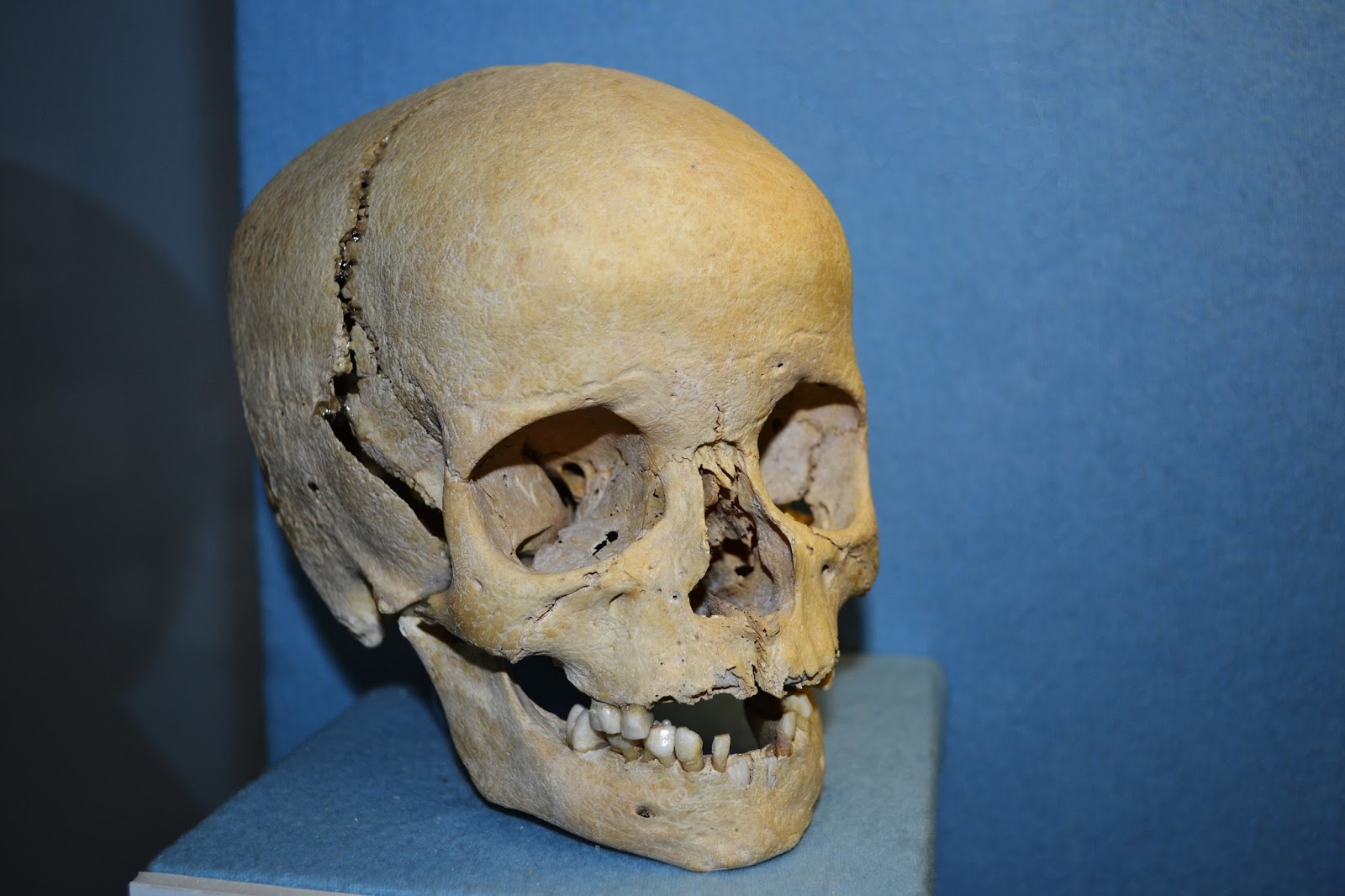 Anthroplogy_-_human_skull_of_a_boy.jpg