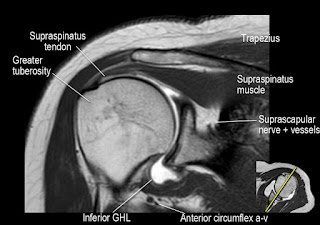 MRI Musculo-Skeletal Section: How to locate glenohumeral ligaments.