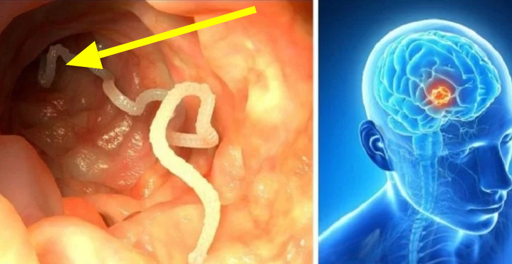 Do Not Eat These Foods, They Cause Worms In Your Body