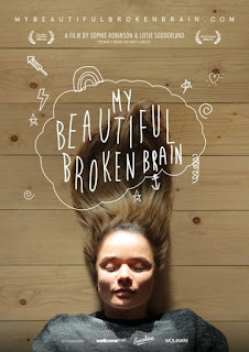 My Beautiful Broken Brain Apenas o Começo