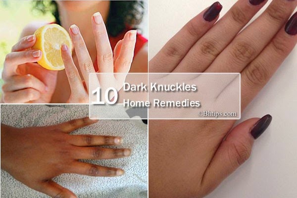 http://www.bhtips.com/2015/05/10-home-remedies-to-lighten-dark-knuckles.html