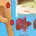Warning Signs You Have Too Many Toxins In Your Body