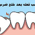 ماذا يجب فعله بعد خلع ضرس العقل ماذا يجب فعله بعد خلع ضرس العقل