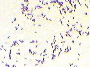 Listeria monocytogenes gram