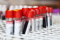 Resultado de imagem para Comissão rejeita doação regular de sangue