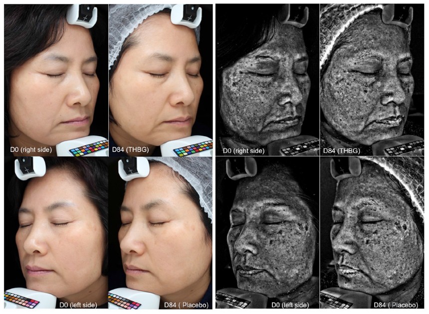 Image Processing Image sources Ultraviolet Imaging