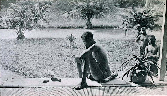 A Congolese man looking at the severed hand and foot of his five-year-old daughter who was killed, and allegedly cannibalized, by the members of Anglo-Belgian India Rubber Company militia. 