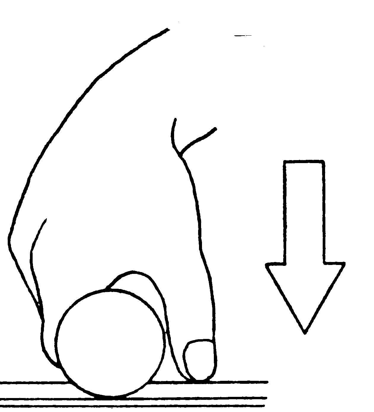 Rimec S.r.l. Oscillating saw injuries during plaster cast removal