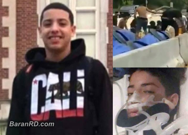 Menor apuñalado por asesinos de Junior sale de hospital con un riñón menos Esaid Hoke