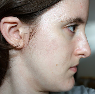 beautypul, adapalene, adapaleno, aging, anti age, envejecimiento, mi experiencia, retinal, retinol, retinyl palmitate, tretinoin, tretinoina, vitamina A, 