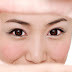 Neogelio Mask - Remove swelling under the eyes &  dark circles under the eyes   
