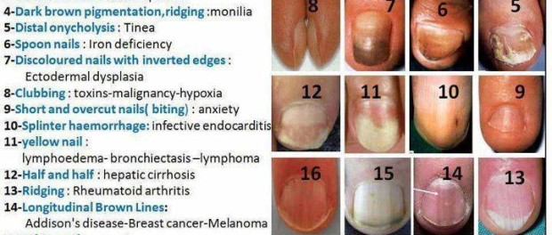 7. Foot Nail Color Changes and Vitamin Deficiencies - wide 7