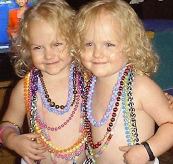 صور بنات توائم اجمل صور اطفال صور بنات 2020 نجوم سورية