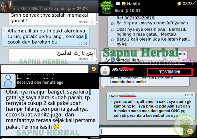 Cara Menyembuhkan Eksim Secara Alami Dengan Cepat, Terbukti Ampuh Cara Menyembuhkan Eksim Secara Alami Dengan Cepat