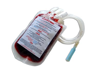 Bolsa transfusion sanguínea Entrevista de Trabajo