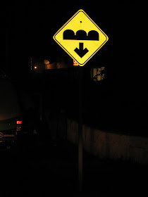 Augmentation Of Labor. Breast augmentation, right