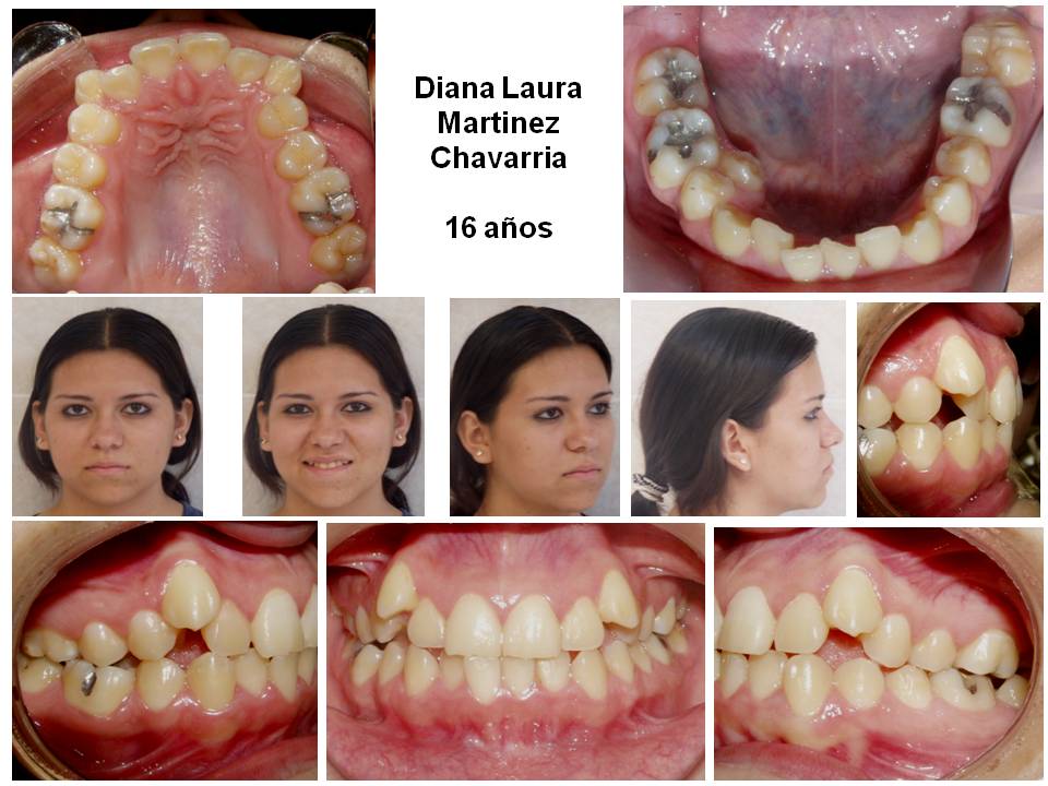 Orthodontist in Nuevo Progreso Brackets ¿QUE ES LA ORTODONCIA?
