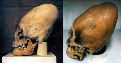 [skull.jpg]