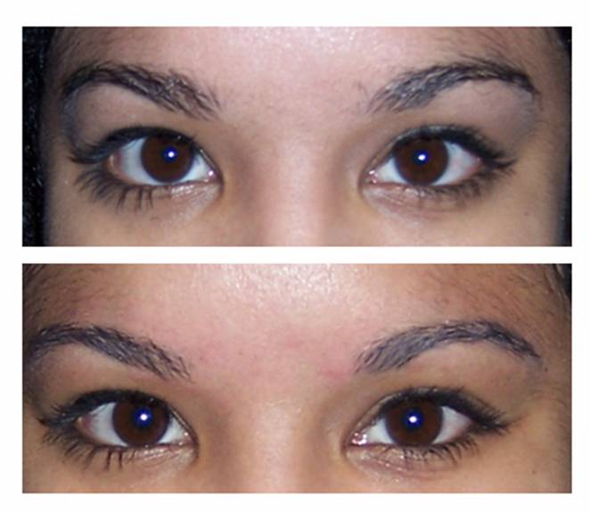 [eyebrow+before+and+after.jpg]